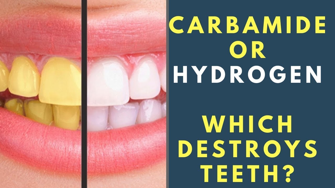 What are the side effects of using hydrogen peroxide for teeth whitening and carbamide